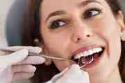 Teeth Cleaning Myths Debunked: The Reassuring Truth from Chester Dental Care