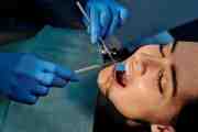 Are You Brushing Too Much? Signs You're Damaging Your Teeth