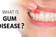 Can Treating Gum Disease Actually Improve Your Blood Sugar? Here's What Research Shows
