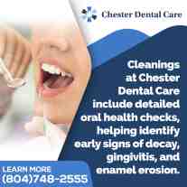 teeth cleaning at Chester Dental Care