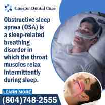 Risk for Obstructive Sleep Apnea