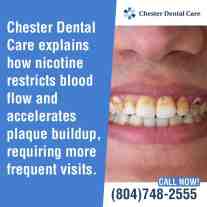 Close-up of stained teeth and plaque buildup highlighted in a dental health promotion by Chester Dental Care.