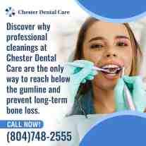 Maintain your oral health and prevent long-term bone loss with professional cleanings.