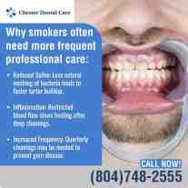 Close-up of a smoker’s teeth with tartar buildup and gum inflammation in a dental awareness graphic.